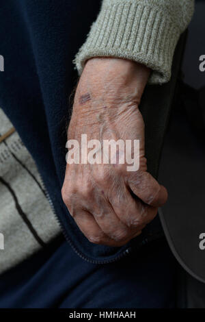 Uomo vecchio, la cura e la malattia, Alter Mann, Pflege, Krankheit Foto Stock