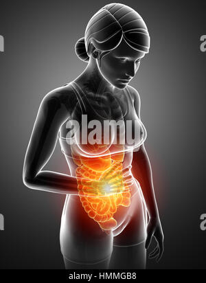Corpo umano anatomia con dolore articolare Foto Stock