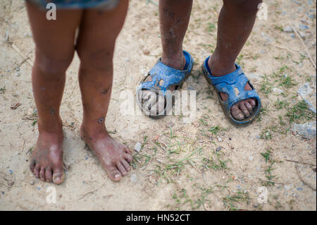 Sporco gambe e piedi Foto Stock