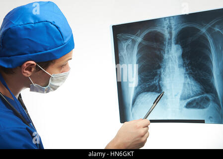 Medico sguardo a raggi x foto di petto isolato su bianco Foto Stock