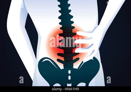 Segnale rosso alla zona della colonna vertebrale. Questa illustrazione di umano dolore alla schiena. Illustrazione Vettoriale