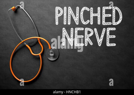 Lavagna con pizzicato concetto del nervo. 3D'illustrazione. Foto Stock