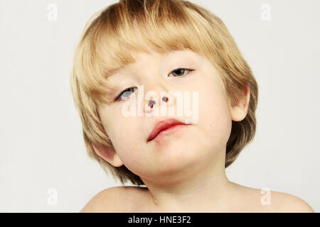 Un giovane ragazzo con un labbro ferito Foto Stock