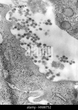 Negativamente macchiate di microscopio elettronico a trasmissione del virus della rosolia virioni germogliando dalla cellula ospite superficie Foto Stock