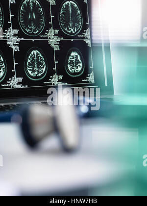 Serie di MRI scansioni cerebrali sullo schermo del computer con uno stetoscopio in primo piano su Doctor's desk Foto Stock