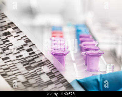 Scienziato tenendo un autoradiogramma di DNA gel che mostra le informazioni genetiche con campioni nel vassoio Foto Stock