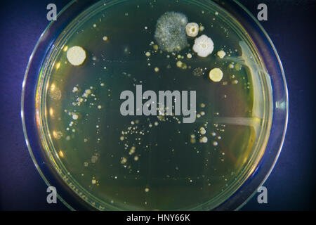 Capsule di Petri con la crescita della microflora. Studio locali igiene ristoranti. La sicurezza alimentare Foto Stock