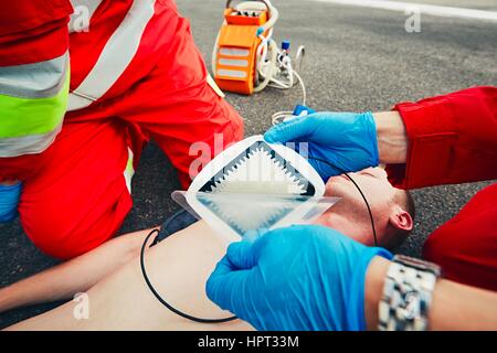 Gli elettrodi del defibrillatore. Squadra di salvataggio (medico e paramedico) resuscita l uomo sulla strada. Foto Stock