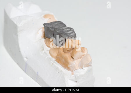 Protesi artificiali nelle fasi di fabbricazione in laboratorio odontotecnico Foto Stock