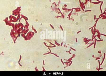 Clostridium perfringens, LM Foto Stock