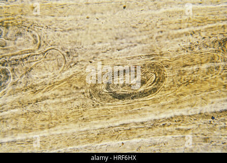 Trichinella spiralis (LM) Foto Stock