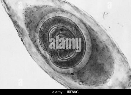 La presenza di trichine nel muscolo (LM) Foto Stock