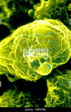 Infezione da HIV-1 T4 linfocita, SEM Foto Stock