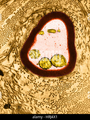 Mielinizzate Axon, TEM Foto Stock
