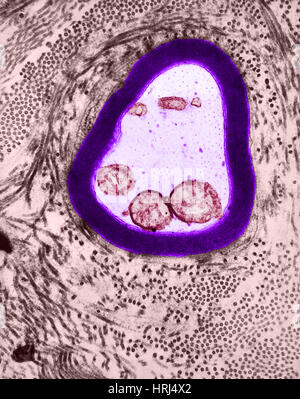 Mielinizzate Axon, TEM Foto Stock