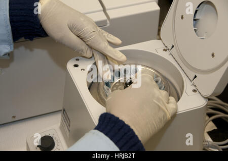 FDA Ricerca di tossicologia, microcentrifuga Foto Stock