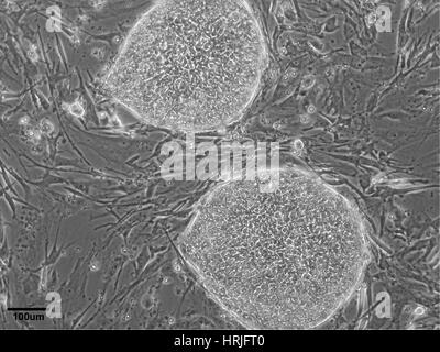 Di cellule staminali embrionali umane Linea WA07 Foto Stock
