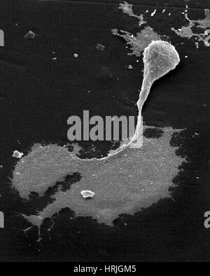 Cellula nervosa con assone e cono di crescita, SEM Foto Stock