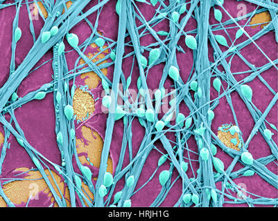 Neuroni e cellule gliali, SEM Foto Stock