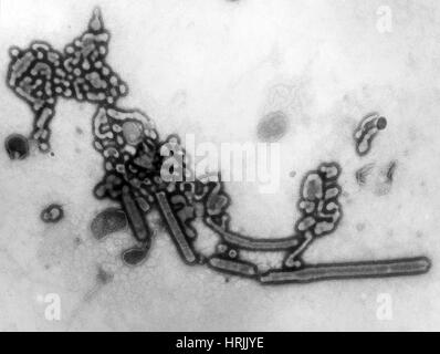 H1N1, dell'influenza A, influenza russa, TEM Foto Stock