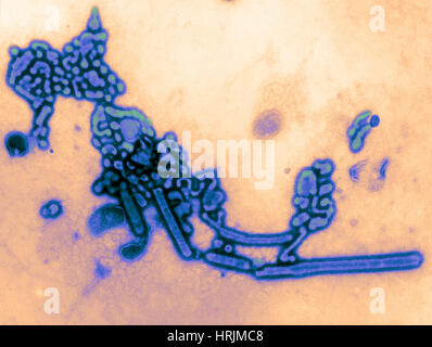 H1N1, dell'influenza A, influenza russa, TEM Foto Stock