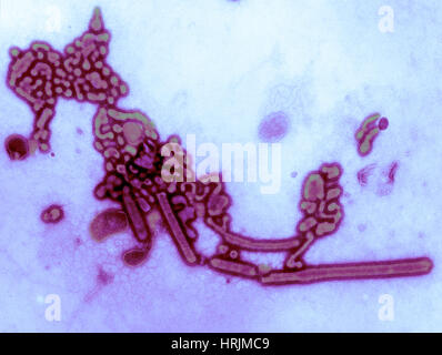 H1N1, dell'influenza A, influenza russa, TEM Foto Stock