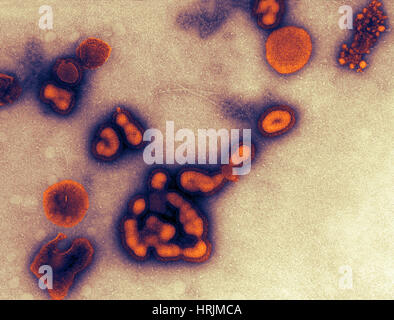 H1N1, dell'influenza A, influenza russa, TEM Foto Stock