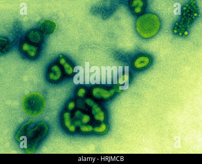 H1N1, dell'influenza A, influenza russa, TEM Foto Stock