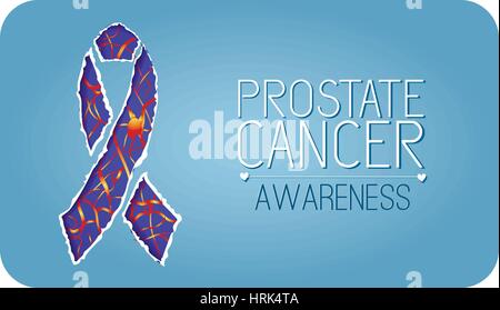 Il cancro della prostata consapevolezza Light Blue Ribbon Illustrazione Vettoriale