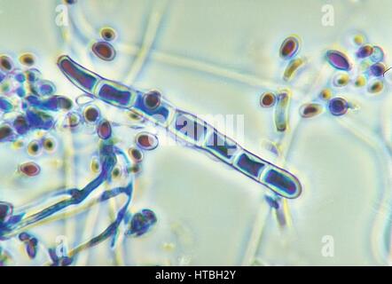 Micrografia di una macroconidium e alcuni microconidia del fungo Trichophyton rubrum var, 1973. rodhaini. Immagine cortesia CDC/Dott. Libero Ajello. Foto Stock