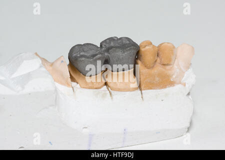 Protesi artificiali nelle fasi di fabbricazione in laboratorio odontotecnico Foto Stock