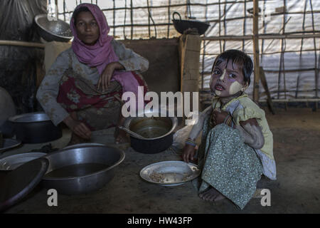 7 marzo 2017 - Cox's Bazar, Chittagong, Bangladesh - Un Rohingya bambino soffre di malnutrizione a Kutupalong Refugee Camp, Cox's Bazar, Bangladesh. Credito: Probal Rashid/ZUMA filo/Alamy Live News Foto Stock