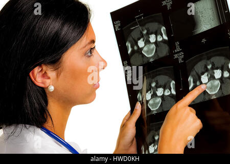 Un medico può contenere i raggi X foto di dischi intervertebrali Infiltrierung in mano, Eine ƒrztin h‰lt das Rˆntgenbild einer Bandscheiben Infiltrierung Foto Stock