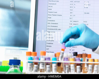 Health Check risultati, Haematologist controllo medico inclusi campioni di sangue per il test con i risultati sullo schermo del computer Foto Stock