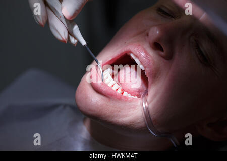 Paziente a dentisti office, ottenere denti esaminati con hand-held mirror e pulizia del tartaro e della placca, prevenire la malattia periodontale. Hygi dentale Foto Stock