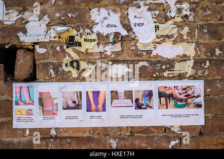 Bhaktapur, Nepal - 20 marzo 2015: poster su una parete di consigliare le persone come prevenire malattia elephantiasis Foto Stock