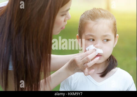 Allergia. Madre aiutare mia figlia soffiare il naso all'esterno, nel parco. Famiglia uno stile di vita all'aperto. Foto Stock