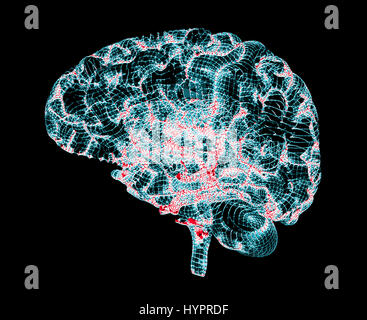 Cervello malattie degenerative, morbo di Parkinson, Sinapsi, neuroni, il morbo di Alzheimer, rendering 3D Foto Stock