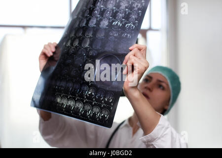 Medico in possesso di una immagine di una risonanza magnetica cerebrale Foto Stock