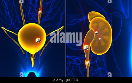 Rene e pietre delle vie urinarie Dolore anatomia maschile organo interno dolorosa minerale cristaline sezione trasversale - 3d illustrazione Foto Stock