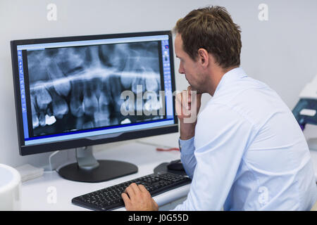 Dentista attento esame di un x-ray sul computer in clinica dentale Foto Stock