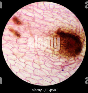 Micrografia di nuovo sporofito di foglia di felce prothallium, sfondo (Fern Prothallium W.M.) Foto Stock