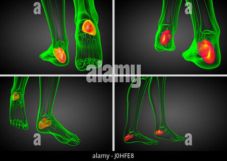 Rendering 3d Illustrazione medica del calcagno osso Foto Stock