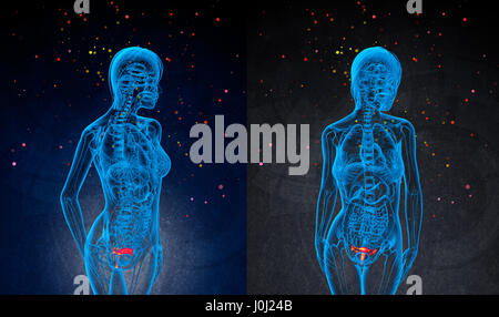3D rendering medical illustrazione del sistema riproduttivo Foto Stock