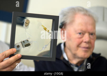 Nikoloz Lasurashvili (L), una gola, naso e orecchio specialista presso il Carl Gustav Carus clinica universitaria, con un apparecchio auditivo impianto e paziente Juergen Schmidt (76) a Dresda, Germania, 10 aprile 2017. Led Lasurashvili un team durante il primo funzionamento nello stato di Sassonia durante il quale un apparecchio acustico è stato impiantato con successo sotto la pelle. Foto: Arno Burgi/dpa-Zentralbild/dpa Foto Stock