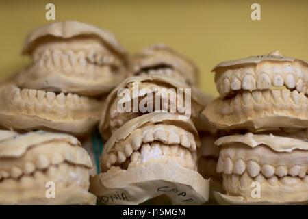 Chiusura del gruppo di impronte dentali, stampi, calchi Foto Stock