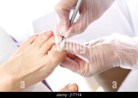 Pedicure, il taglio delle pelli. Estetista esegue pedicure, pulisce e tagli le unghie al feetNail pulizia nel salone di bellezza Foto Stock