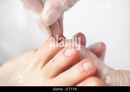 Pedicure, il taglio delle pelli. Estetista esegue pedicure, pulisce e tagli le unghie al feetNail pulizia nel salone di bellezza Foto Stock