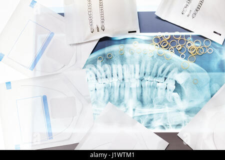 Molti strumenti dentali per le parentesi graffe compresi gli anelli di lattice e i fermi giacciono sulla ganascia di raggi X Foto Stock