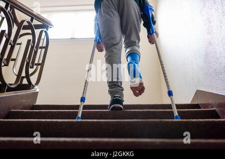 Un giovane adulto con le stampelle e il suo piede bendato in gesso è ascendente gradini di una scala all'interno di un apartment house. A piedi nudi le dita dei piedi sono unità organizzativa bloccata Foto Stock